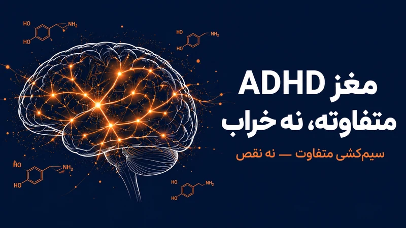 علت اختلال بیش فعالی